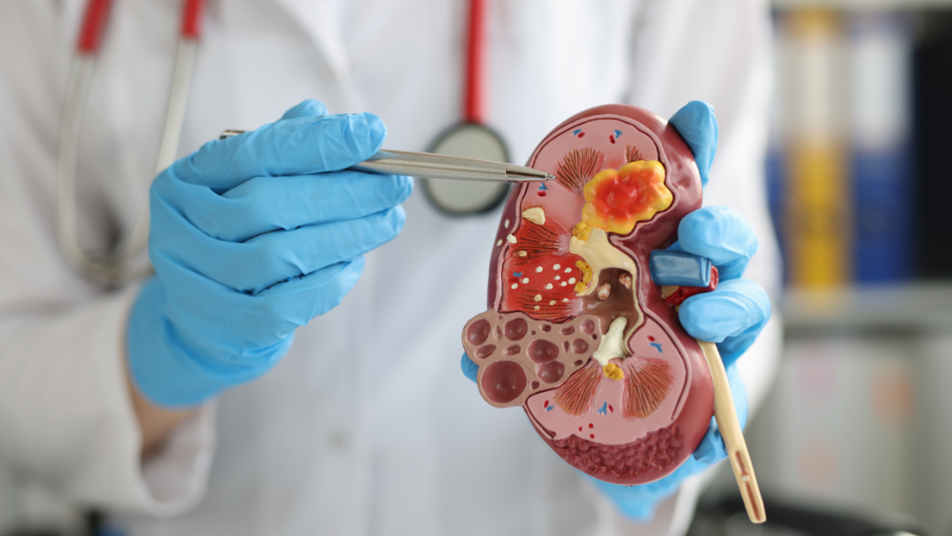 Nephrology (Kidney Care)